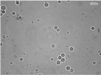 Puriﬁed and diluted Coccidioides protoplasts.